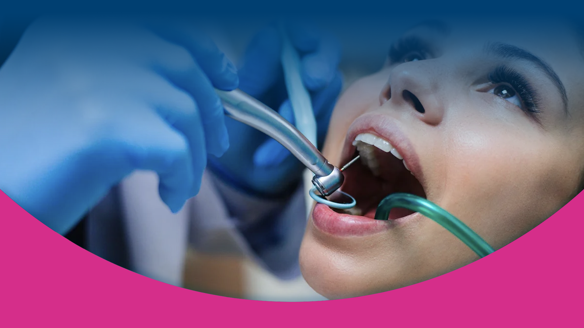 Il nostro medico esperto di endodonzia a DentalPiù di Sassari, Sanluri e Nuoro interviene con tecniche avanzate per curare i denti in profondità, permettendo ai pazienti di sorridere di nuovo senza dover ricorrere all'estrazione. Grazie alle nostre soluzioni innovative, possiamo trattare l'infiammazione dei tessuti interni causata da carie profonde o fratture dentali, restituendo la salute e la bellezza del sorriso. Sei pronto a Sorridere?