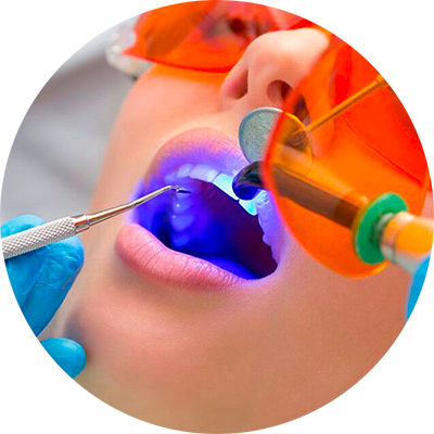 Dentista di DentalPiù esegue una terapia conservativa su una paziente nelle cliniche di Sassari, Sanluri e Nuoro, utilizzando strumenti innovativi per curare le carie e preservare la salute dei denti