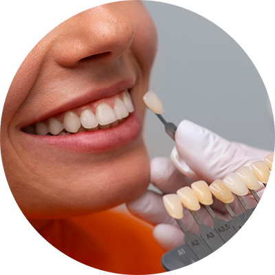 Medico di DentalPiù in Sassari, Sanluri e Nuoro che esegue trattamenti estetici per il sorriso, inclusi faccette estetiche, sbiancamento, rimodellamento dei denti e allungamento di corona per migliorare forma, colore e proporzioni dei denti e gengive