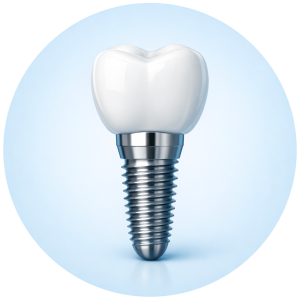 Implantologia dentale in Sardegna per sostituire denti mancanti