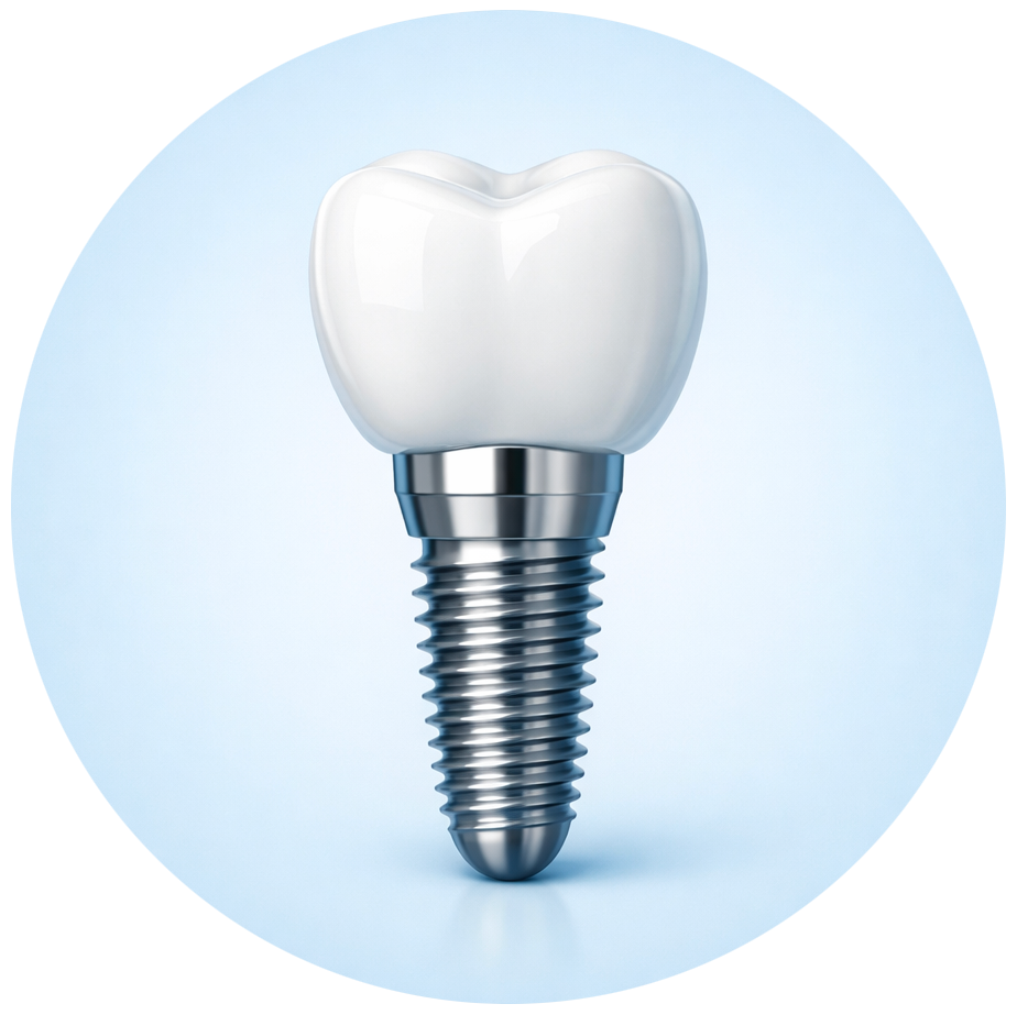 Implantologia dentale in Sardegna per sostituire denti mancanti